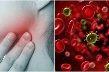 8 dấu hiệu cảnh báo ung thư máu
