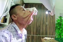 Người mang “gương mặt quỷ” mắc căn bệnh cực hiếm