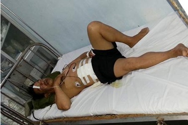 Bệnh xá đảo Trường Sa lớn cứu thành công bệnh nhân bị viêm ruột thừa