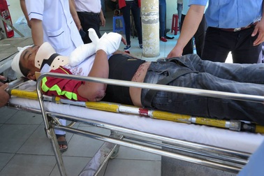 Nạn nhân bàng hoàng kể khoảnh khắc xe chở 30 du khách lật trên đèo