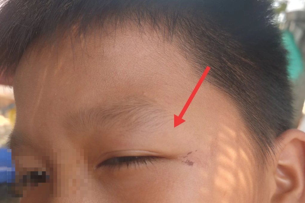 5 em nhỏ bị đánh liên tiếp vào mặt, bắt quỳ vì ném đá trúng cổng hàng xóm - 1 5 em nhỏ bị đánh liên tiếp vào mặt, bắt quỳ vì ném đá trúng cổng hàng xóm - 1