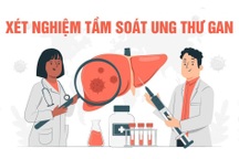 Xét nghiệm AFP có thể tầm soát ung thư gan?