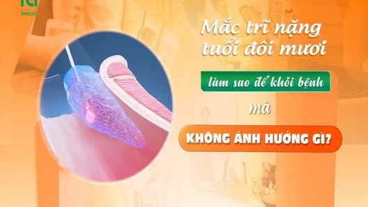 Giải pháp loại bỏ trĩ không dao kéo, êm ái, không chảy máu