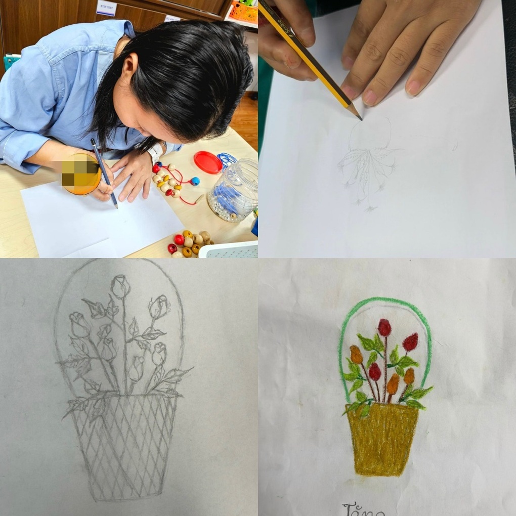 6 tiếng tạo nên kỳ tích cho người phụ nữ bị đứt lìa bàn tay phải - 3 6 tiếng tạo nên kỳ tích cho người phụ nữ bị đứt lìa bàn tay phải - 3