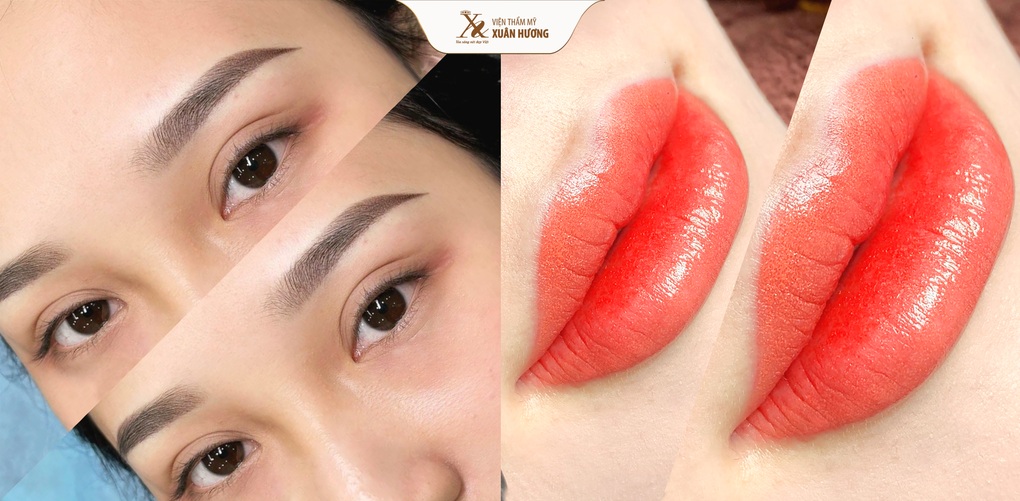 Viện thẩm mỹ Xuân Hương tung ưu đãi dịp sinh nhật 35 tuổi - 5 Viện thẩm mỹ Xuân Hương tung ưu đãi dịp sinh nhật 35 tuổi - 5