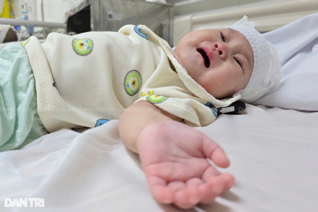 Bé 7 tháng tuổi khuyết hộp sọ, mẹ nghèo khẩn cầu cơ hội sống cho con - 1 Bé 7 tháng tuổi khuyết hộp sọ, mẹ nghèo khẩn cầu cơ hội sống cho con - 1
