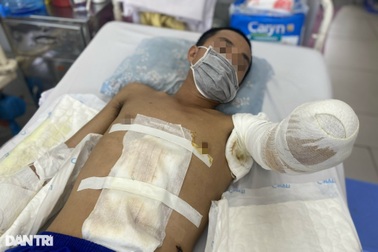 Gia tăng bỏng điện: Nhiều người bị cắt cụt tay, chân