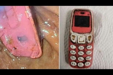 Người đàn ông nuốt chiếc điện thoại di động