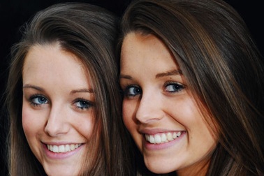 Cặp song sinh giống nhau như hai giọt nước