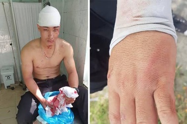 TP HCM: Nhóm nhân viên công ty bảo vệ và thu hồi nợ bị tấn công