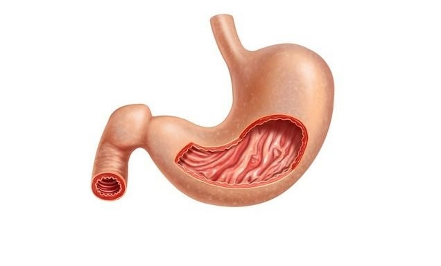 Nguy cơ ung thư từ viêm teo niêm mạc dạ dày - 1 Nguy cơ ung thư từ viêm teo niêm mạc dạ dày - 1