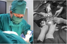 Hà Nội: Người đàn ông bị chém gần đứt rời cẳng chân, sốc mất máu