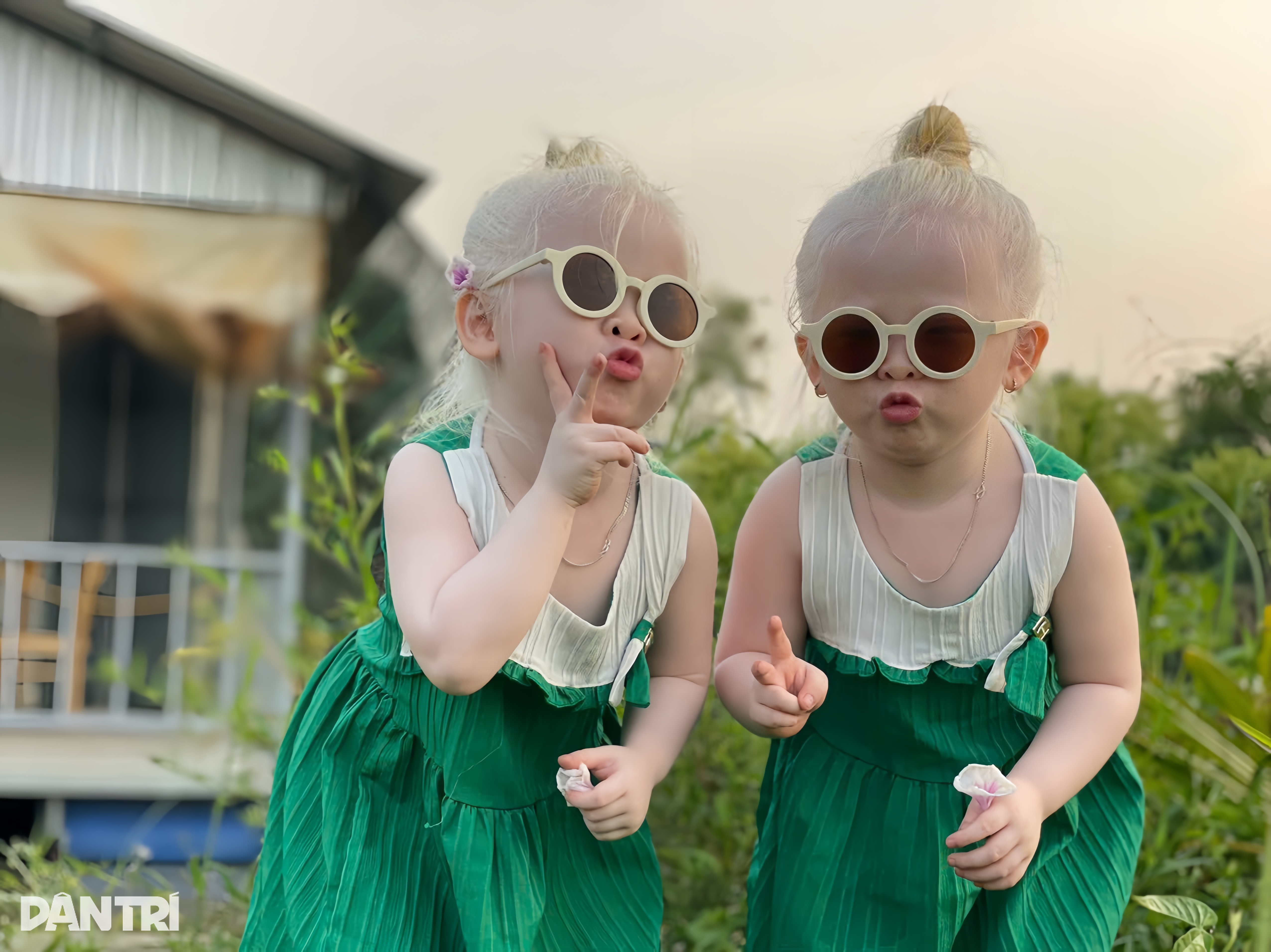 Sinh 3 đứa con bạch tạng, vợ Rồng chồng Mây ở Cần Thơ nổi tiếng khắp vùng - 6