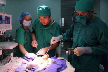 Bé gái vừa chào đời lộ nội tạng ra ngoài