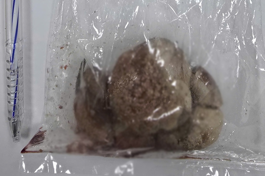 Cô gái nguy kịch sau 1 năm bị hành xác tại khu Tam Thái Tử, hiện ra sao? - 3