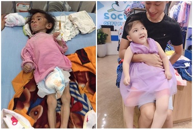 Sự thay đổi bất ngờ của em bé suy dinh dưỡng Lào Cai sau khi được nhận nuôi
