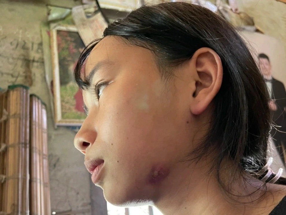 Nỗi đau khắc khoải của người mẹ mang HIV và điều kỳ diệu với 2 con gái - 5 Nỗi đau khắc khoải của người mẹ mang HIV và điều kỳ diệu với 2 con gái - 5