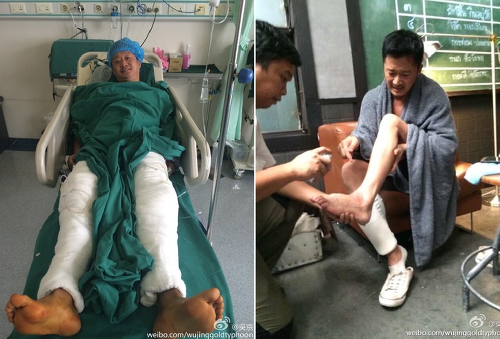 Sự điên rồ của Ngô Kinh: Bán nhà để làm phim, khâu hơn 100 mũi khắp người - 6 Sự điên rồ của Ngô Kinh: Bán nhà để làm phim, khâu hơn 100 mũi khắp người - 6