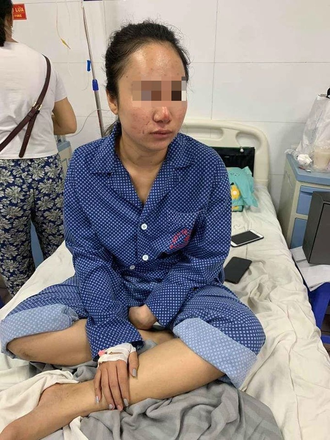 Vụ cô gái xinh đẹp bị đánh, lột quần áo giữa phố: Nạn nhân hoảng loạn, đang điều trị tại bệnh viện - Ảnh 2.