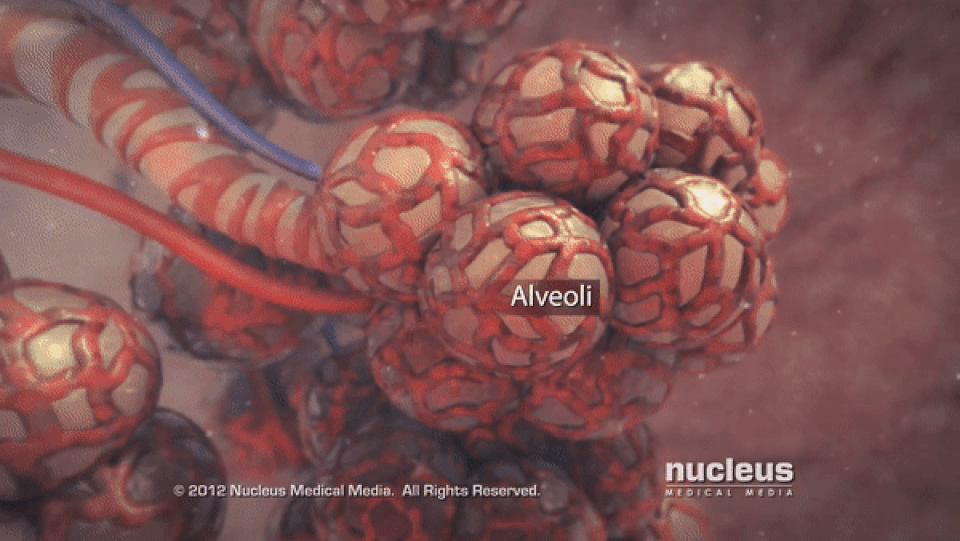 Virus corona gây viêm phổi như thế nào? - 1 Virus corona gây viêm phổi như thế nào? - 1