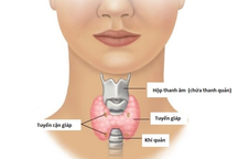 5 triệu chứng cảnh báo ung thư tuyến giáp