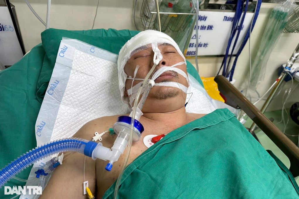 Áo mưa vướng bánh xe máy, thầy giáo cấp 2 nguy kịch tính mạng - 2 Áo mưa vướng bánh xe máy, thầy giáo cấp 2 nguy kịch tính mạng - 2