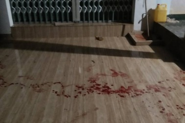 Chủ nhà bị tên trộm đâm liên tục 7 nhát để tẩu thoát