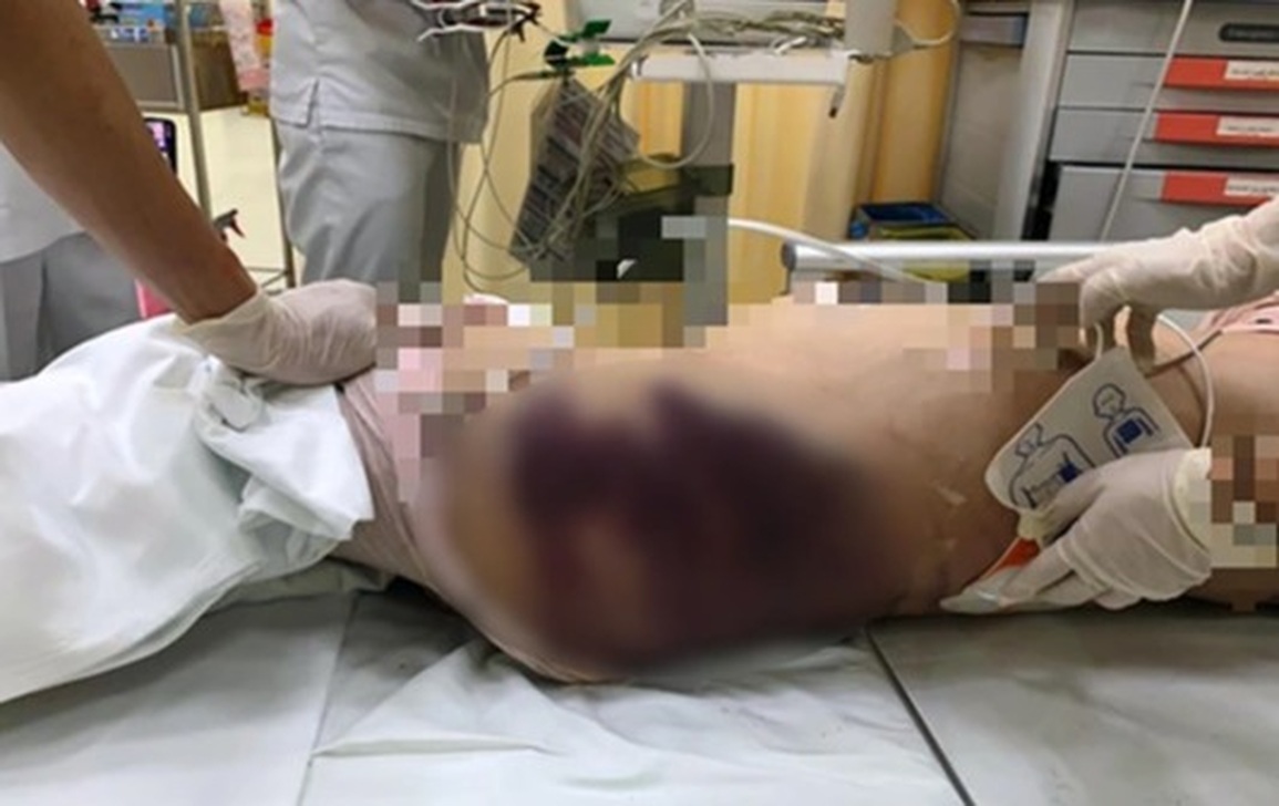 Phẫn nộ về cái chết của bé gái nghi bị người tình của bố bạo hành - 1 Phẫn nộ về cái chết của bé gái nghi bị người tình của bố bạo hành - 1