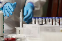 Sáng 3/6, thêm 57 ca Covid-19 tại 5 địa phương