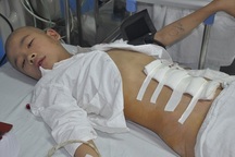 Bị u nguyên bào thần kinh, sự sống bé 10 tuổi nguy kịch