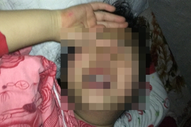 Hà Nội: Cháu bé nghi bị xâm hại nhiều lần đang rất hoảng loạn