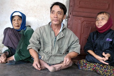 Chuyện đời đầy nước mắt của anh Què