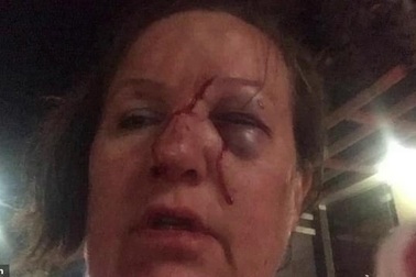 Du khách lãnh đòn oan khi đứng quay video đánh nhau