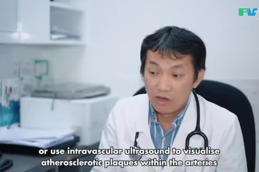 Công nghệ hình ảnh OCT giúp chẩn đoán chính xác tổn thương mạch vành