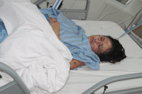 Đã giám sát những người tiếp xúc với bệnh nhân viêm mô não cầu