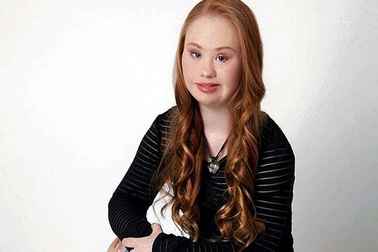 Cô gái Down quyết thay đổi diện mạo và trở thành người mẫu