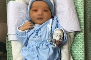 Bé sơ sinh bị bỏ rơi giữa trời nắng 40 độ không bị tổn thương mắt, tai