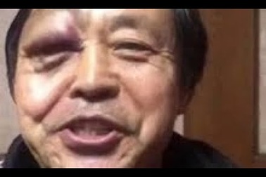 Đại sư Thái Cực Quyền bị đánh sưng húp mắt, thua đo ván sau 30 giây