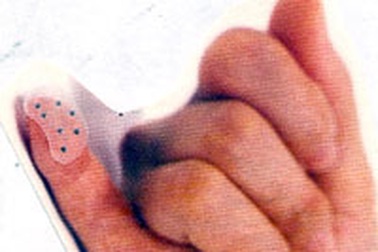 Hai phương pháp mới chữa chứng đau nửa đầu