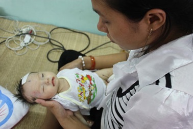 Bạn đọc sẻ chia cùng bé 2 tháng tuổi mắc chứng rối loạn hiếm gặp