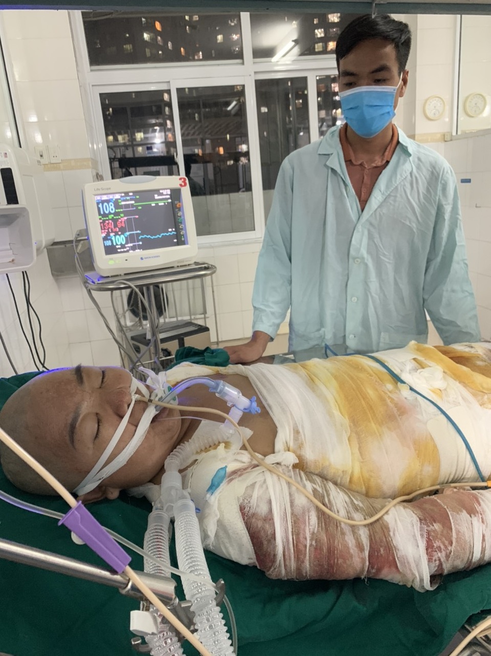 Đau nhói lòng cảnh người mẹ đi kiếm cái ăn nuôi 3 con bị ngã vào bếp hấp cá - 2 Đau nhói lòng cảnh người mẹ đi kiếm cái ăn nuôi 3 con bị ngã vào bếp hấp cá - 2
