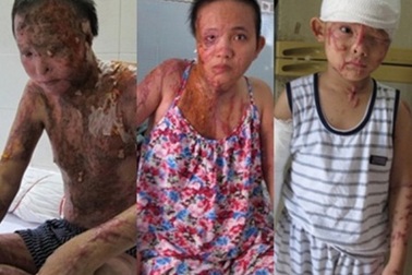 Tạm đình chỉ điều tra vì kẻ gây án “dở chứng”… tâm thần