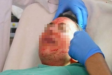 Tiếp cận công nghệ kinh rợn dùng máu người tái tạo da ở Sài Gòn