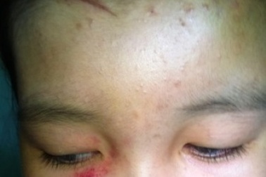 Nữ sinh dùng thước đánh bạn giữa sân trường