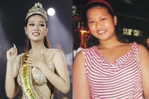 Tân Hoa hậu Thiên Ân: Từng nặng 75kg, bị rạn da vùng ngực vì giảm cân nhanh