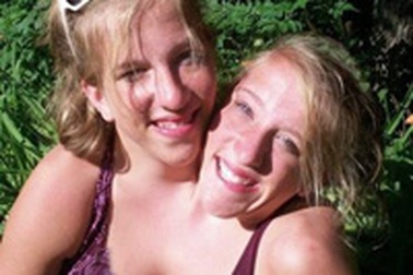 Những cặp song sinh kỳ lạ nhất trong lịch sử (2)