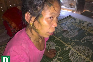 Hai mẹ con bị hàng trăm con ong tấn công khi vào rừng lấy củi