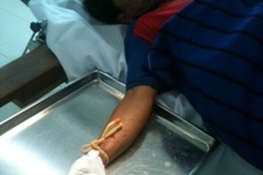 Nối thành công bàn tay bị mìn nổ tan