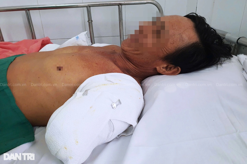 Người đàn ông bị điện phóng cụt 2 tay nghẹn ngào: Mọi người đừng như tôi - 2 Người đàn ông bị điện phóng cụt 2 tay nghẹn ngào: Mọi người đừng như tôi - 2
