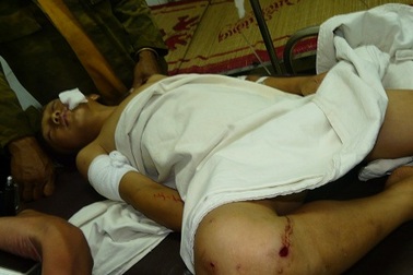 Học sinh thứ 3 tử vong trong vụ nổ đầu đạn ở Đắk Nông